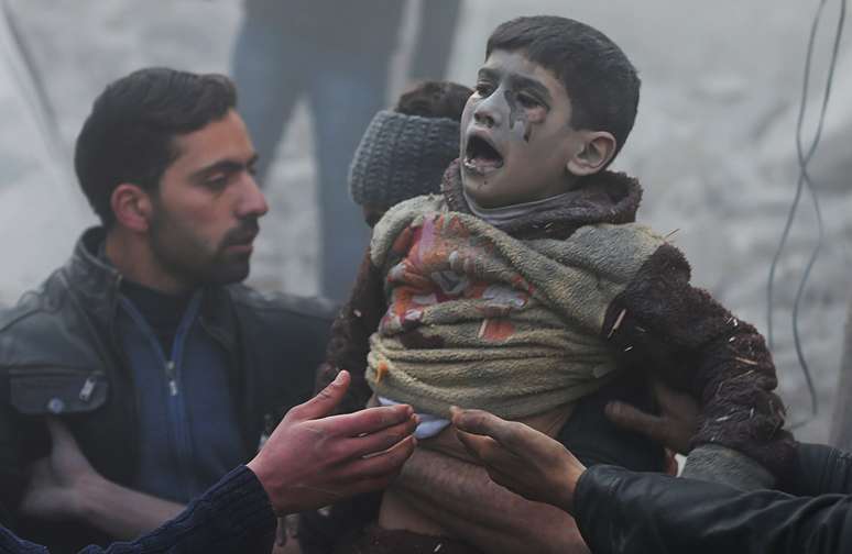 Menino sobrevivente ao bombardeio: ao menos uma criança não resistiu ao ataque aéreo