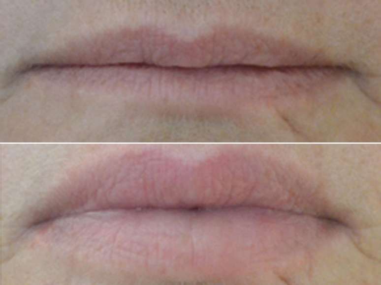 <p>O site da empresa mostra o&nbsp;"antes" e "depois" do uso do produto&nbsp;</p>