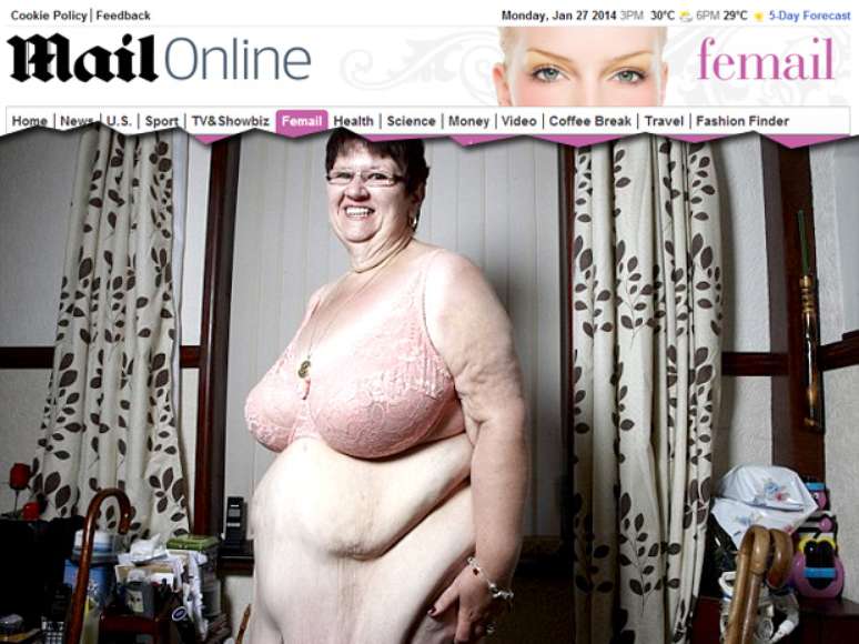 <p>Pauline contabiliza mais de 12 quilos de pele após o procedimento cirúrgico</p>