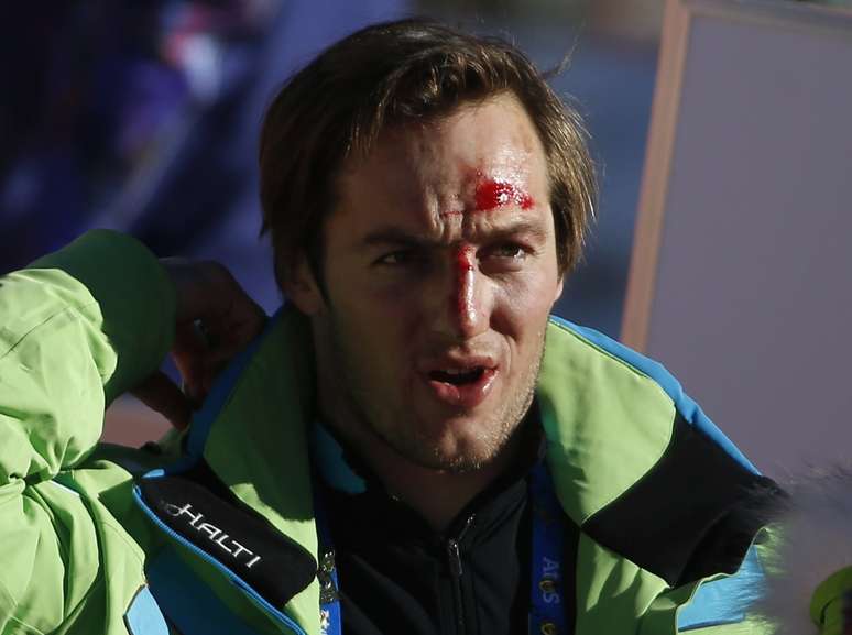 Esloveno Rok Perko lesionou o rosto após queda no ski alpino downhill