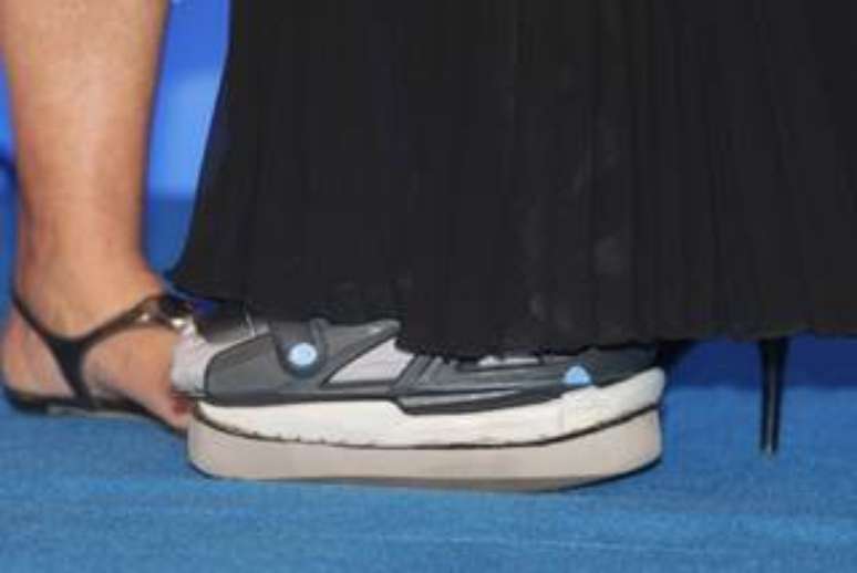 <p>Xuxa tem usado a bota ortopédica em eventos</p>