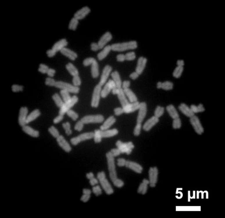 Imagem de cromossomos humanos durante uma de suas fases de formação
