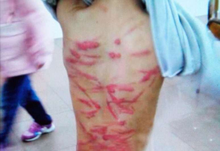 Uma mulher chinesa agrediu o filho de seis anos com um cabide de ferro  por ele não ter feito a lição de casa