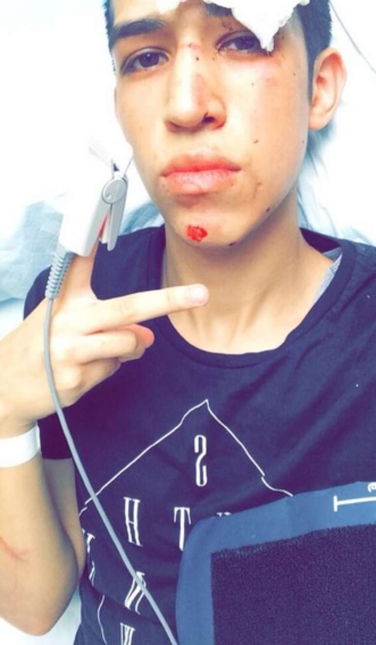 Sobrevivente de acidente na Califórnia posta foto em cama de hospital