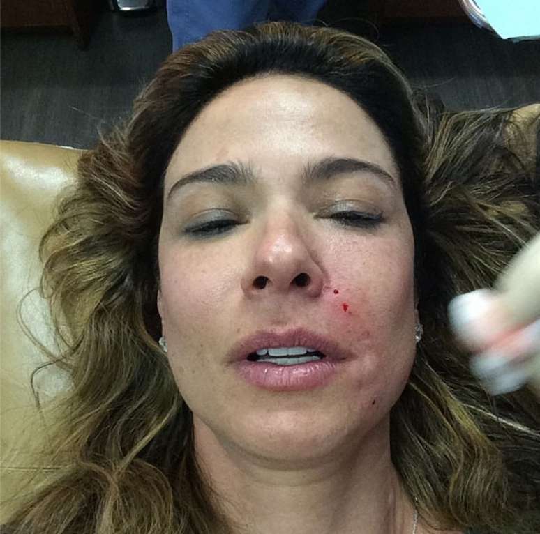 Famosa compartilhou vídeos com etapas do procedimento