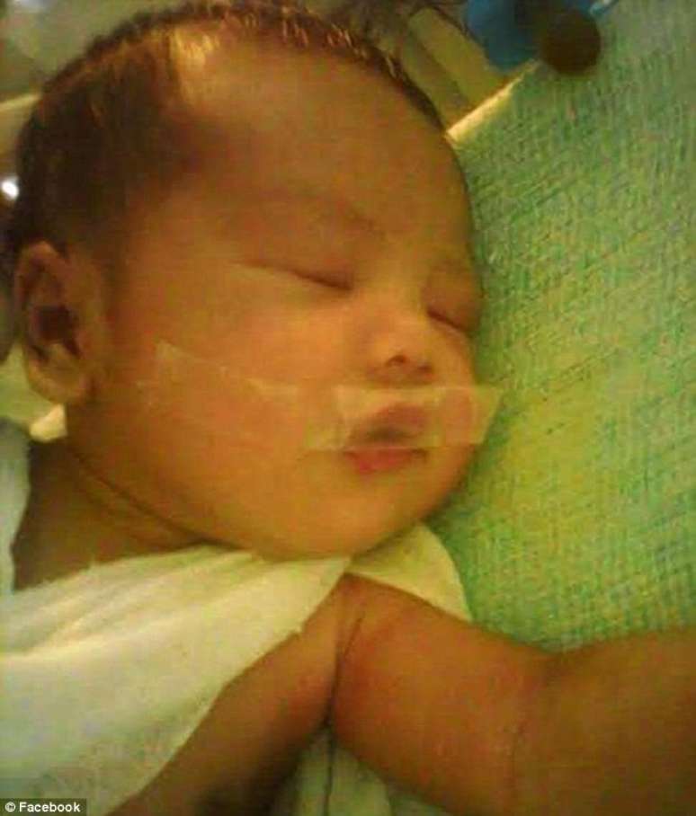 Bebê teve boca lacrada com fita adesiva em hospital, segundo reclamou seus pais; caso ainda é investigado