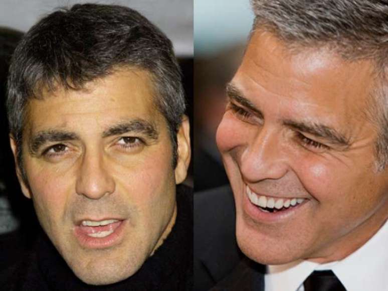 <p>Desde antes de tener la sonrisa perfecta, George Clooney ya se robaba los suspiros de las damas. Ahora que el talento se vio forzado a hacer una fabulosa metamorfosis con su sonrisa, el actor es uno de los hombres más deseados y admirados del cine.</p>