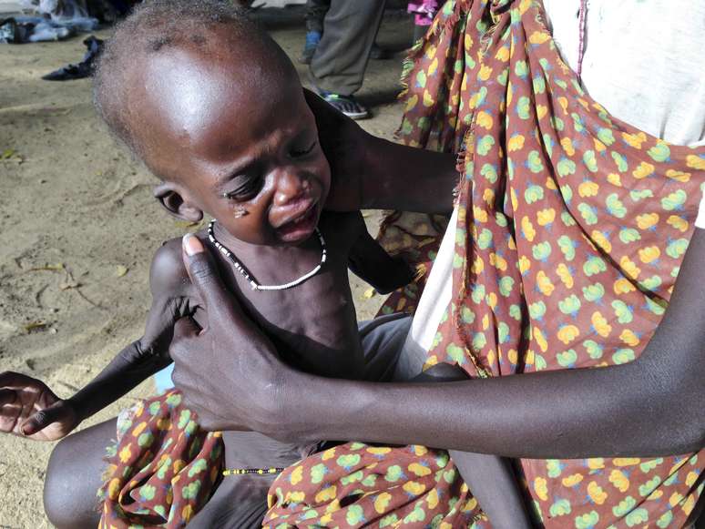 <p>Milhares de pessoas, incluindo crianças, sofrem com a fome no Sudão do Sul</p>