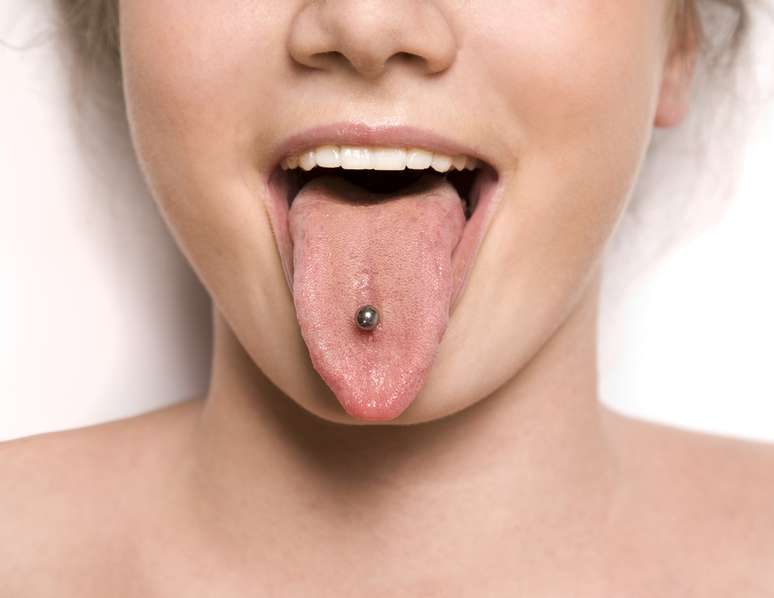 <p>Desde hace muchos años, la utilización del piercing oral  lingual, labial y en el frenillo  se ha transformado en una forma de expresión estética y modificación corporal común entre los jóvenes. </p>