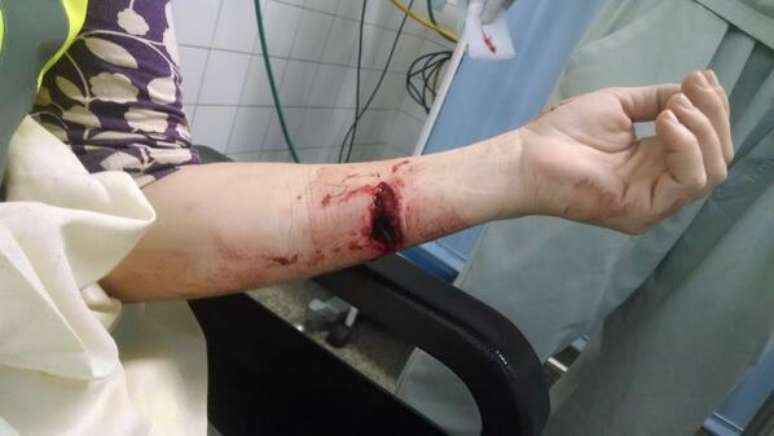 Jornalista da CNN postou em seu Twitter ferimento no braço após confronto entre manifestantes e PMs