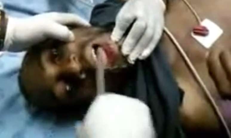 Homem é atendido no hospital após chegar com um celular preso na boca