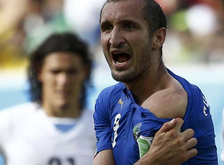 Zagueiro italiano Chiellini mostra seu ombro após incidente com uruguaio Luis Suárez.