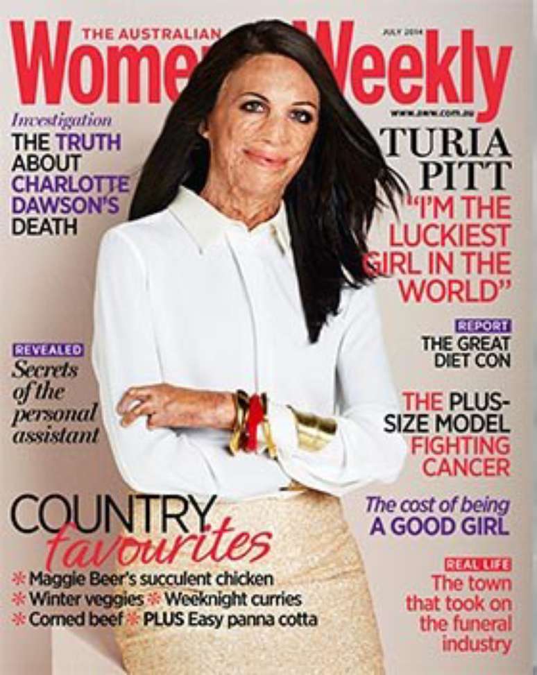 <p>Turia Pitt é capa da edição de julho da revista australiana</p>