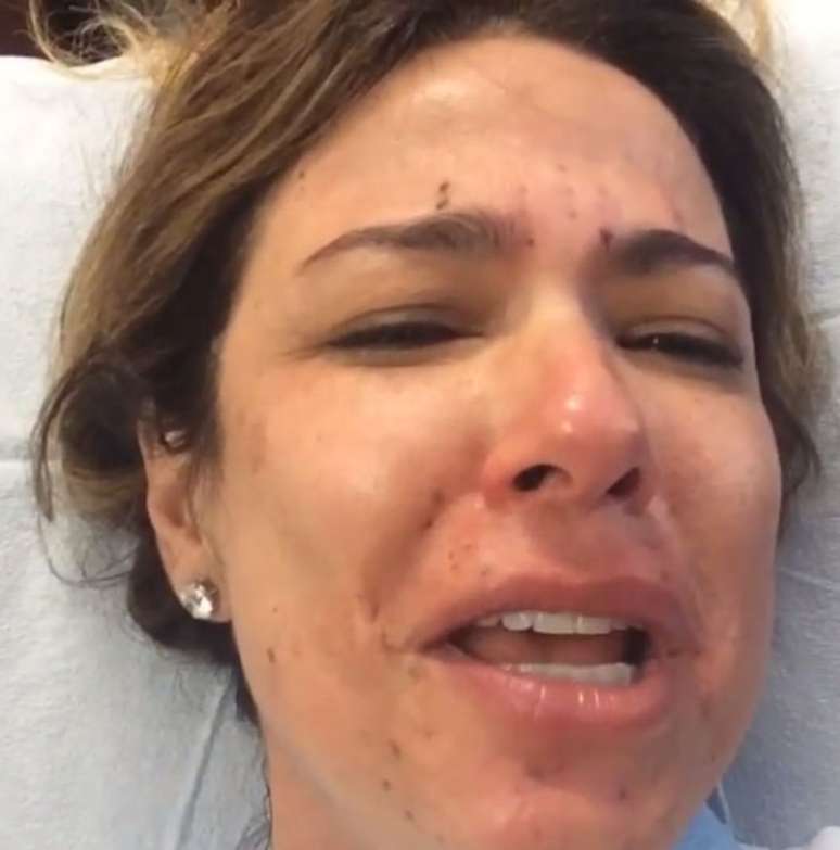 Luciana Gimenez chora ao fazer tratamento de pele; assista