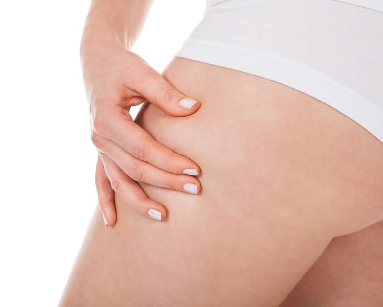 Solu&ccedil;&atilde;o de beleza dispon&iacute;vel no mercado promete reduzir em at&eacute; 80% as estrias que atingem a pele de boa parte das mulheres 