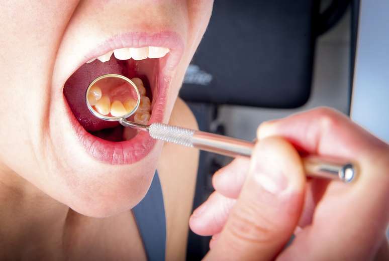 <p>Las bacterias orales pueden causar infecciones secundarias o la inflamación de otros tejidos</p>