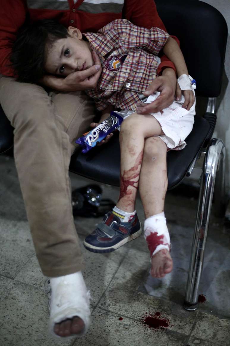 Criança ferida por ataque na cidade síria de Douma