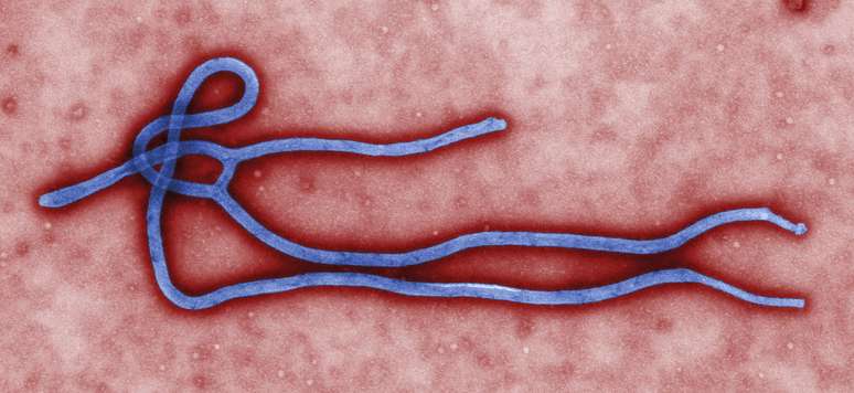 <p>Estrutura do vírus do ebola visto por um microscópio</p>