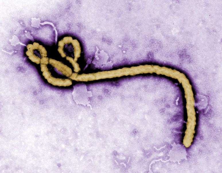 <p>Morfologia ultraestrutural do vírus ebola em foto colorida</p>
