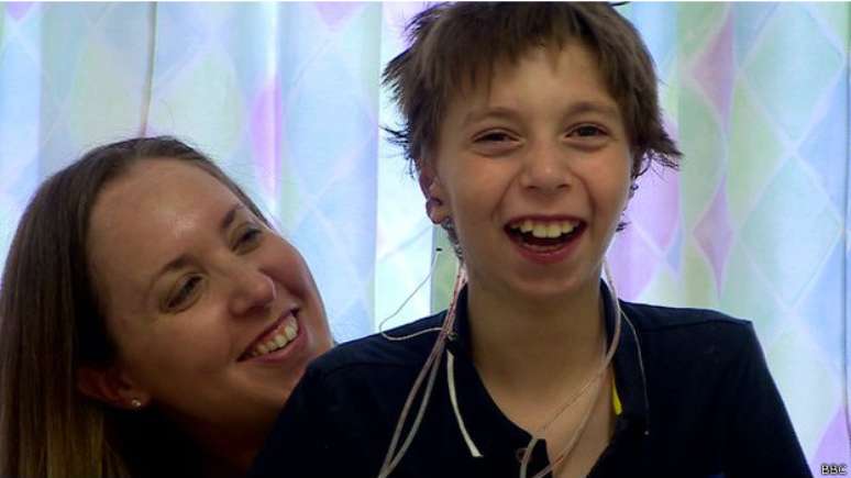 <p>Kieran fica surpreso e muito feliz ao ver o resultado da operação</p>