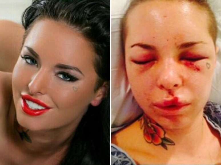 Christy Mack ficou com o rosto deformado após agressão de lutador de MMA