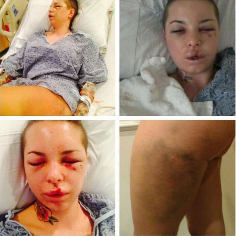 Christy Mack publicou em seu Twitter imagens das agressões