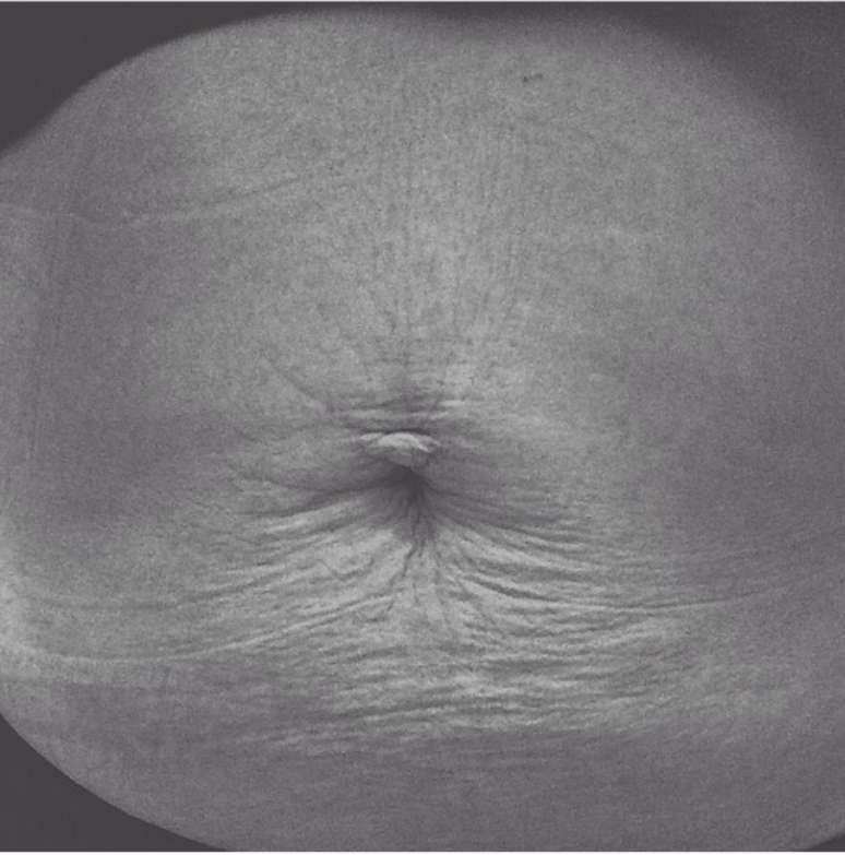 Mãe manda foto da barriga após dar à luz menino