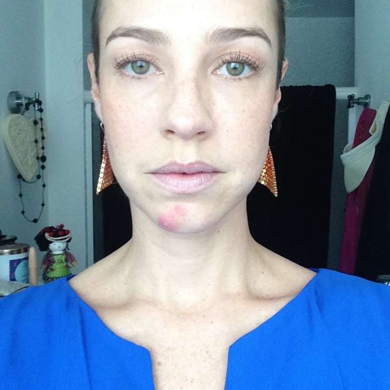 <p>Luana Piovani exibiu uma baita espinha em foto sem maquiagem postada nesta sexta-feira (26), em seu perfil no Instagram.&nbsp;&nbsp;&quot;Jaja cubro a safada&quot;, brincou</p>