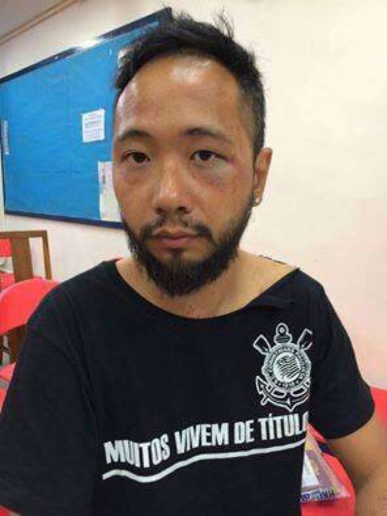 O ativista foi fotografado com hematomas por espancamento sofrido pela polícia, segundo partido