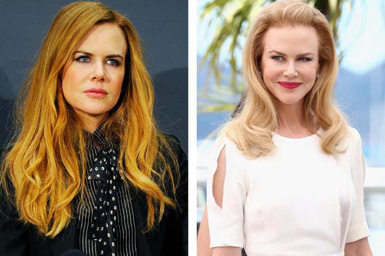 Nicole Kidman antes e depois do botox