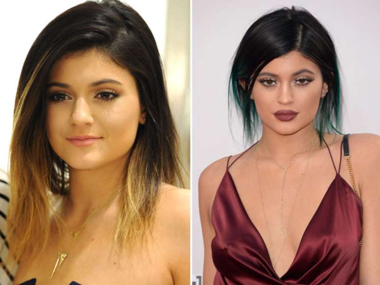 <p>Foto de janeiro de 2014 (&agrave; esq.) em compara&ccedil;&atilde;o com atual; boca de modelo foi ficando mais carnuda</p>