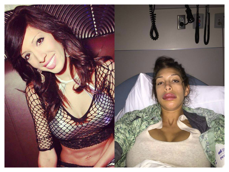 Farrah Abraham fica irreconhec&iacute;vel ap&oacute;s cirurgia 