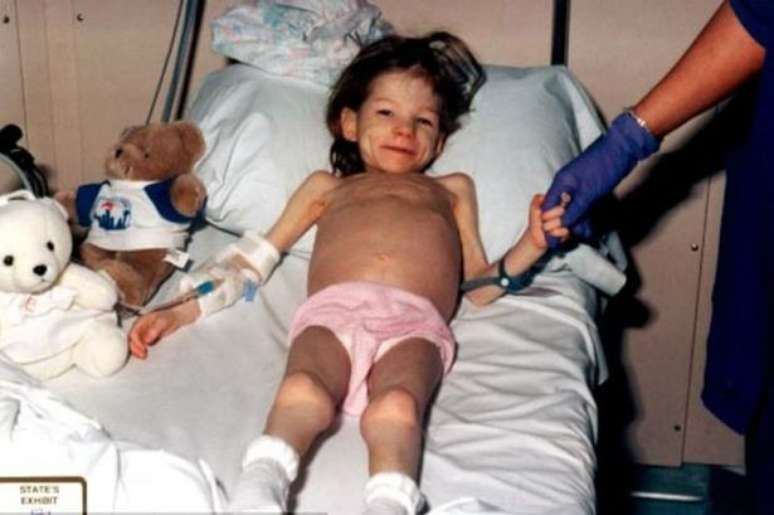 Quando foi encontrada pela polícia, a menina pesava apenas 11kg, aos oito anos, e teve de receber tratamento no hospital