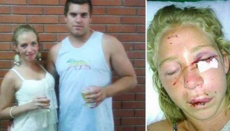 Cristian Pilotti, 25 anos, é acusado de tentativa de homicídio pela agressão que cometeu contra sua ex-namorada, Victoria Montenegro, 25 anos