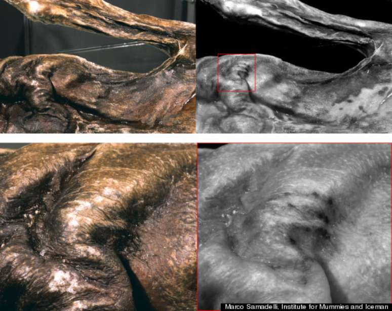 A análise da pele da múmia revelou a nova tatuagem escondida em camadas mais profundas da pele de cor escura de Ötzi