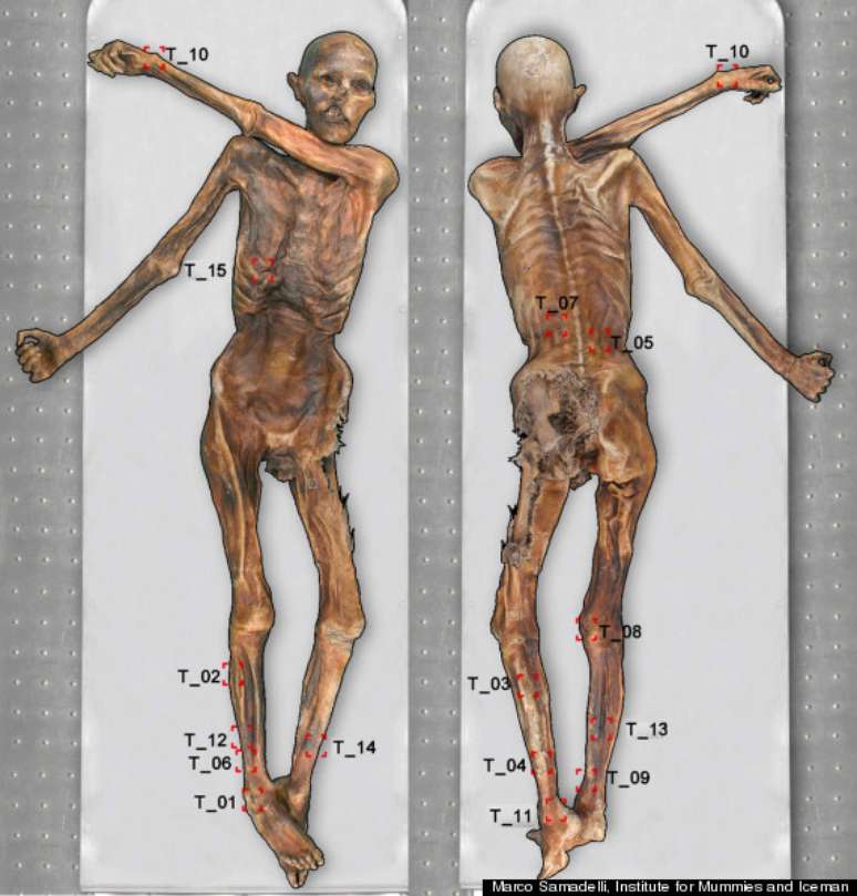 Tatuagens encontradas em fósseis levam cientistas a acreditar que faziam parte de rituais de acupuntura 