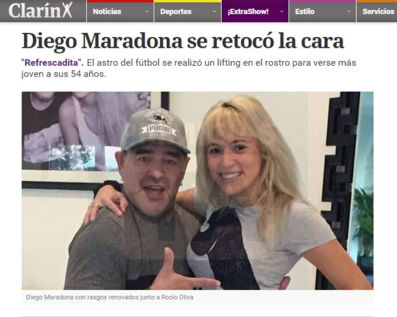 <p>Clarín revelou que Diego Maradona fez plástica no rosto</p>