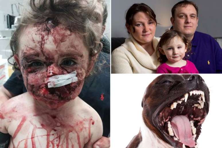 Uma menina de 1 ano e meio quase morreu após ser atacada por um cão bull terrier na sua própria casa