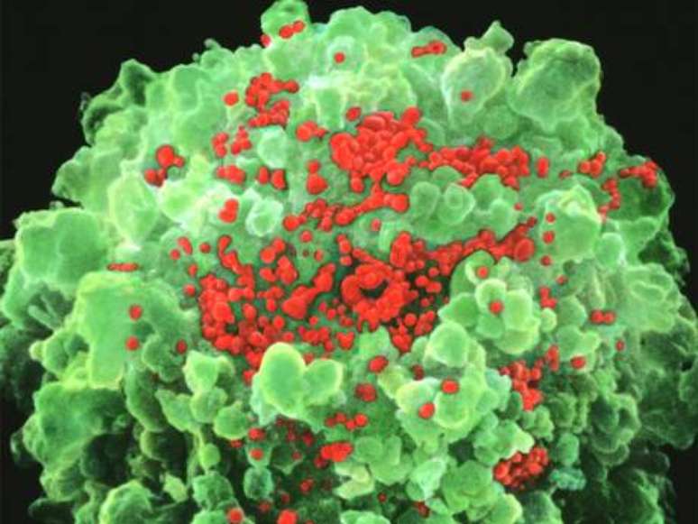 O vírus da Aids em imagem de microscópio: nova pílula sugere esperança para tratamento