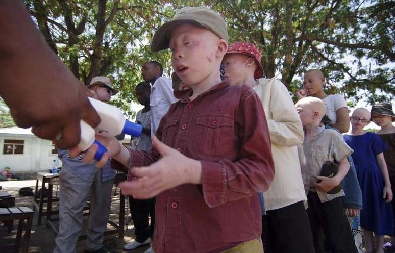 <p>A ONU denunciou um aumento desde 2013 de ataques contra albinos na Tanzânia</p>