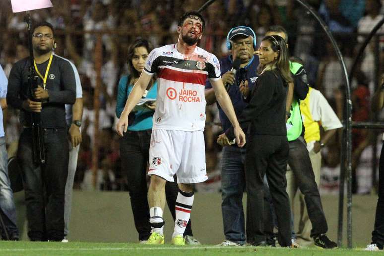 João Paulo sangra após marcar pelo Santa Cruz