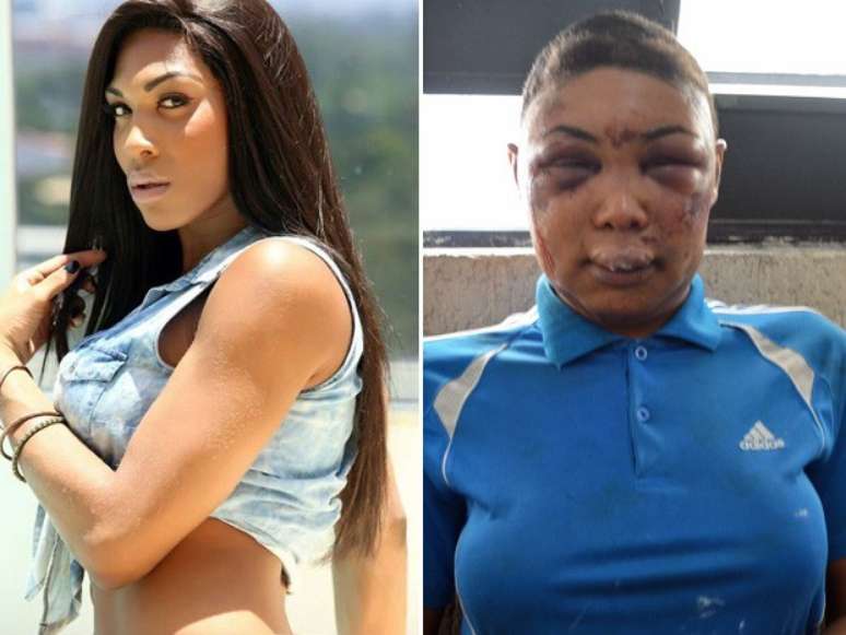 <p>A travesti Verônica Bolina, antes e depois de ser presa em São Paulo </p>