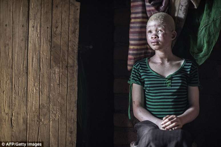 <p>Catherine Amidu, 12 anos, em sua casa casa no Malawi, em uma região onde seis albinos foram mortos desde dezembro</p>