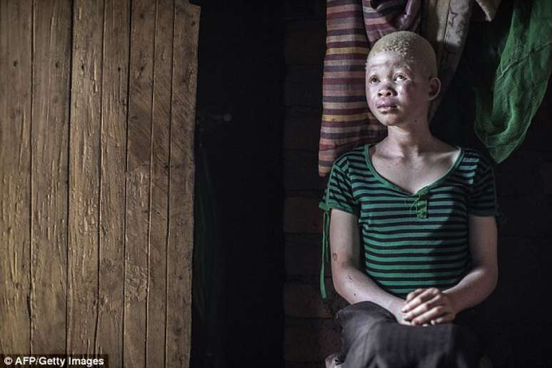 Catherine Amidu, 12 anos, em sua casa casa no Malau&iacute;, em uma regi&atilde;o onde seis albinos foram mortos desde dezembro