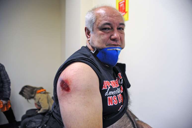 Grevista atendido por profissionais da saúde ferido por bala de borracha