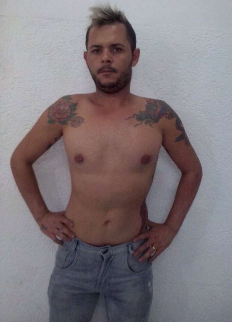 Rodrigo Cunha perdeu 25 kg e ficou com peitoral flácido: depois da prótese, disse que não tem mais vergonha de ir à praia
