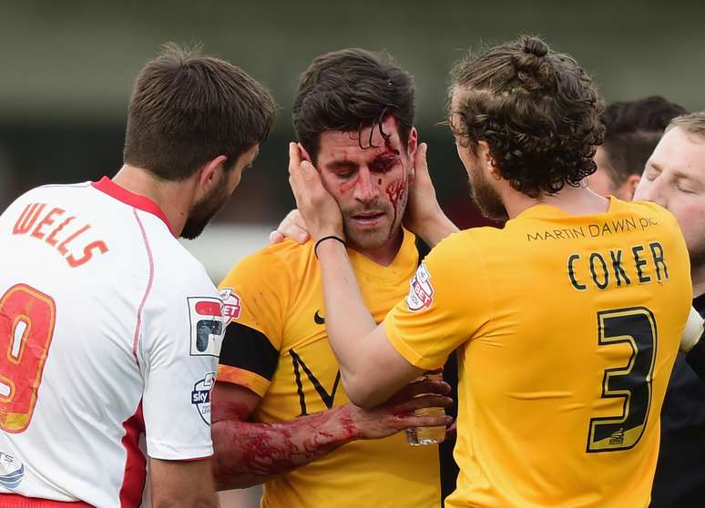 Michael Timlin sofreu corte profundo em partida neste domingo