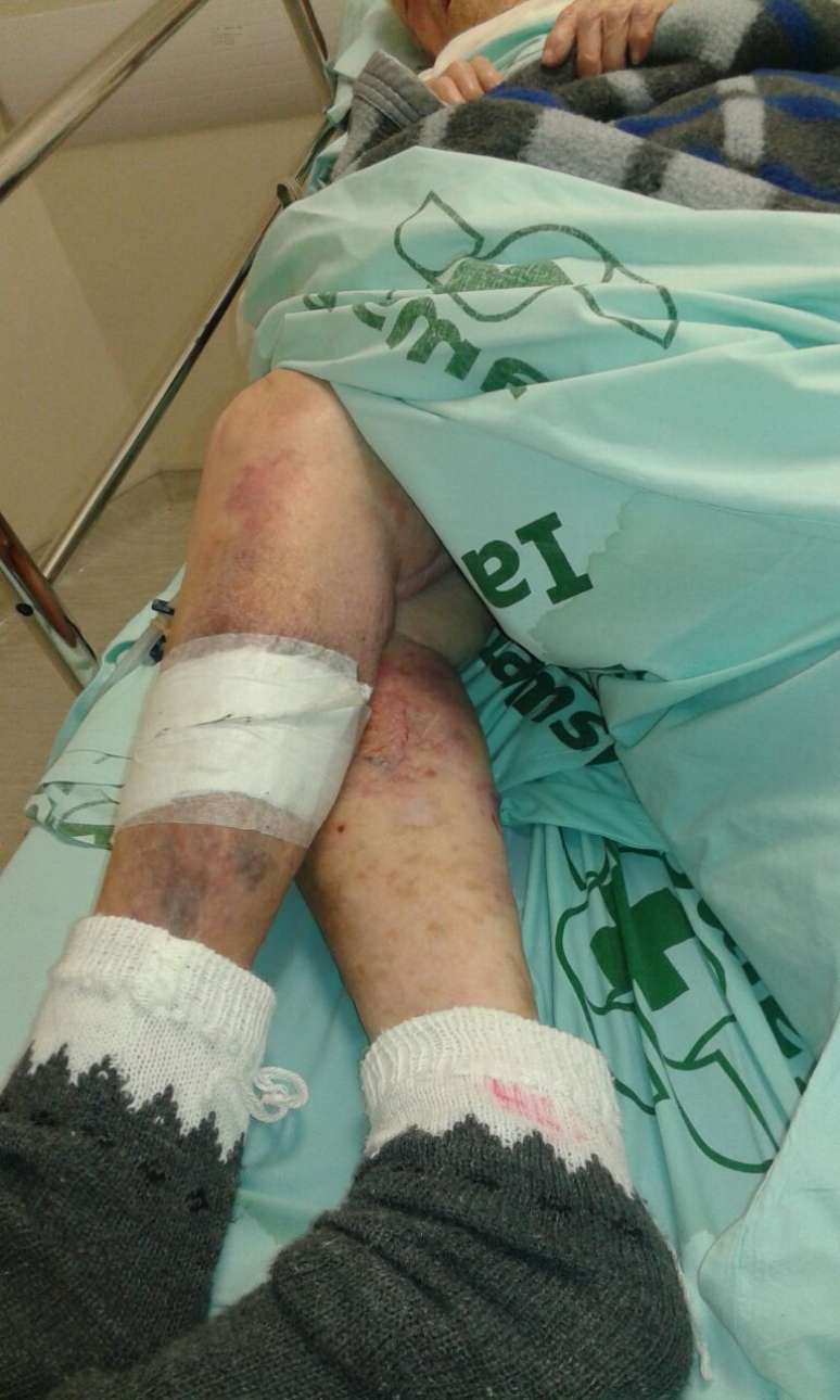 Paciente foi transferida para enfermaria do pronto socorro na tarde de segunda-feira