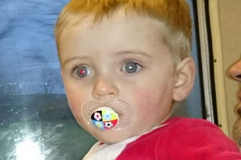 Zak Sutherland foi diagnosticado com retinoblastoma, um tipo raro de câncer de olho que afeta crianças menores de cinco anos