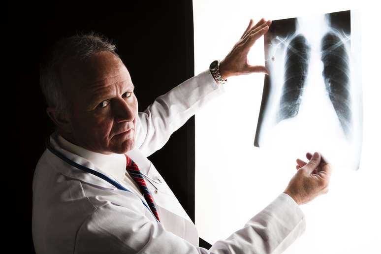 Novo tratamento mostrou eficiência para redução de tumores em casos avançados de câncer de pulmão